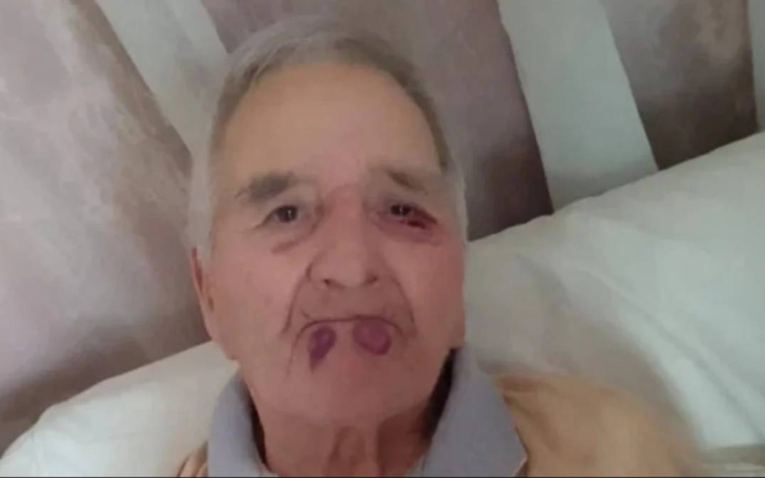 Brutal agresión a un jubilado en un geriátrico de Mar del Plata