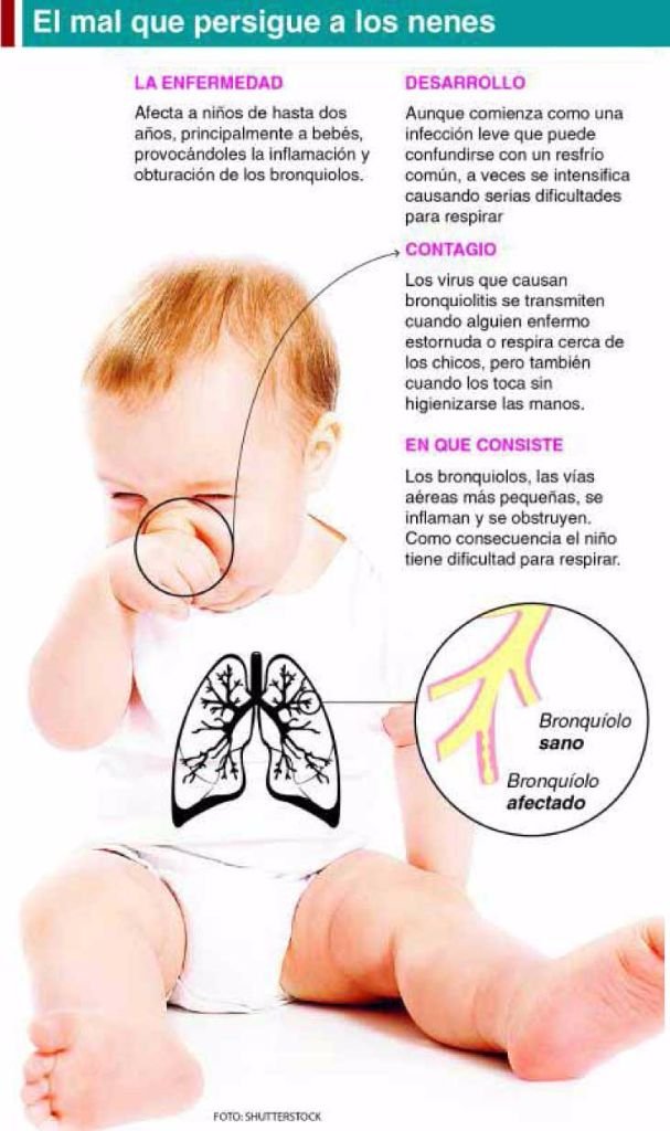 Bronquiolitis: puede afectar a 70% de bebés