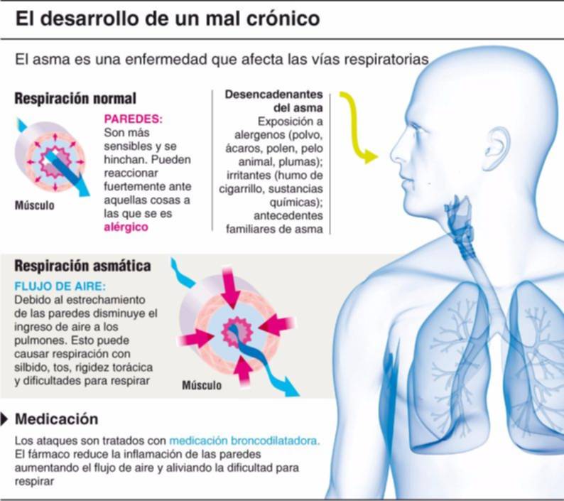 Cuidar el ambiente, clave para pacientes con asma