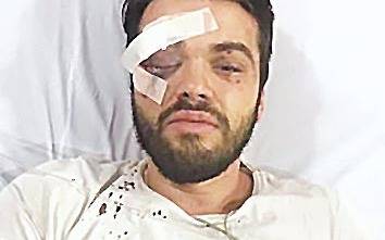 Denuncian brutal ataque de una patota a un rugbier “por gay”