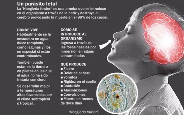 ¿Cuales son los síntomas de Infección?