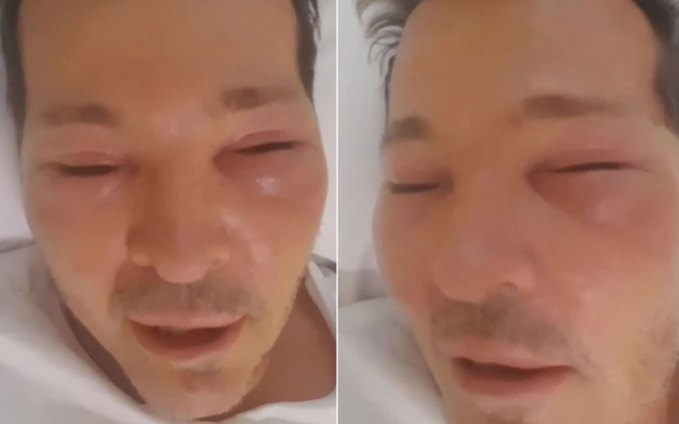 Preocupación por la salud de Guido Süller: internado con la cara desfigurada