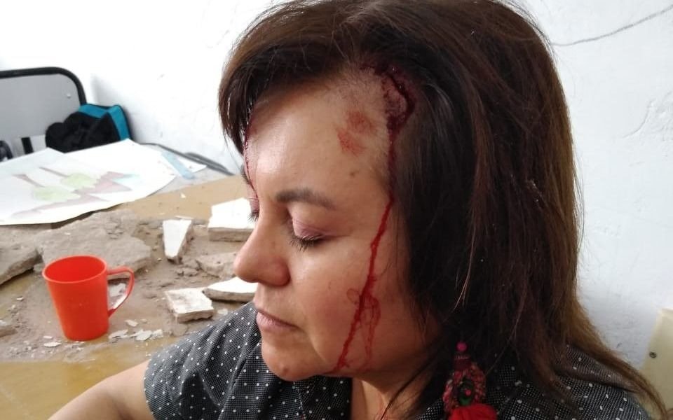 Una docente está herida: se le cayó el techo dando clases
