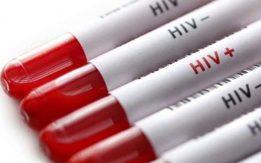 Convocan a una jornada de concientización sobre VIH en 25 y 44
