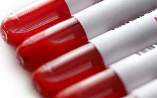 Los bancos de sangre, con abastecimiento muy bajo