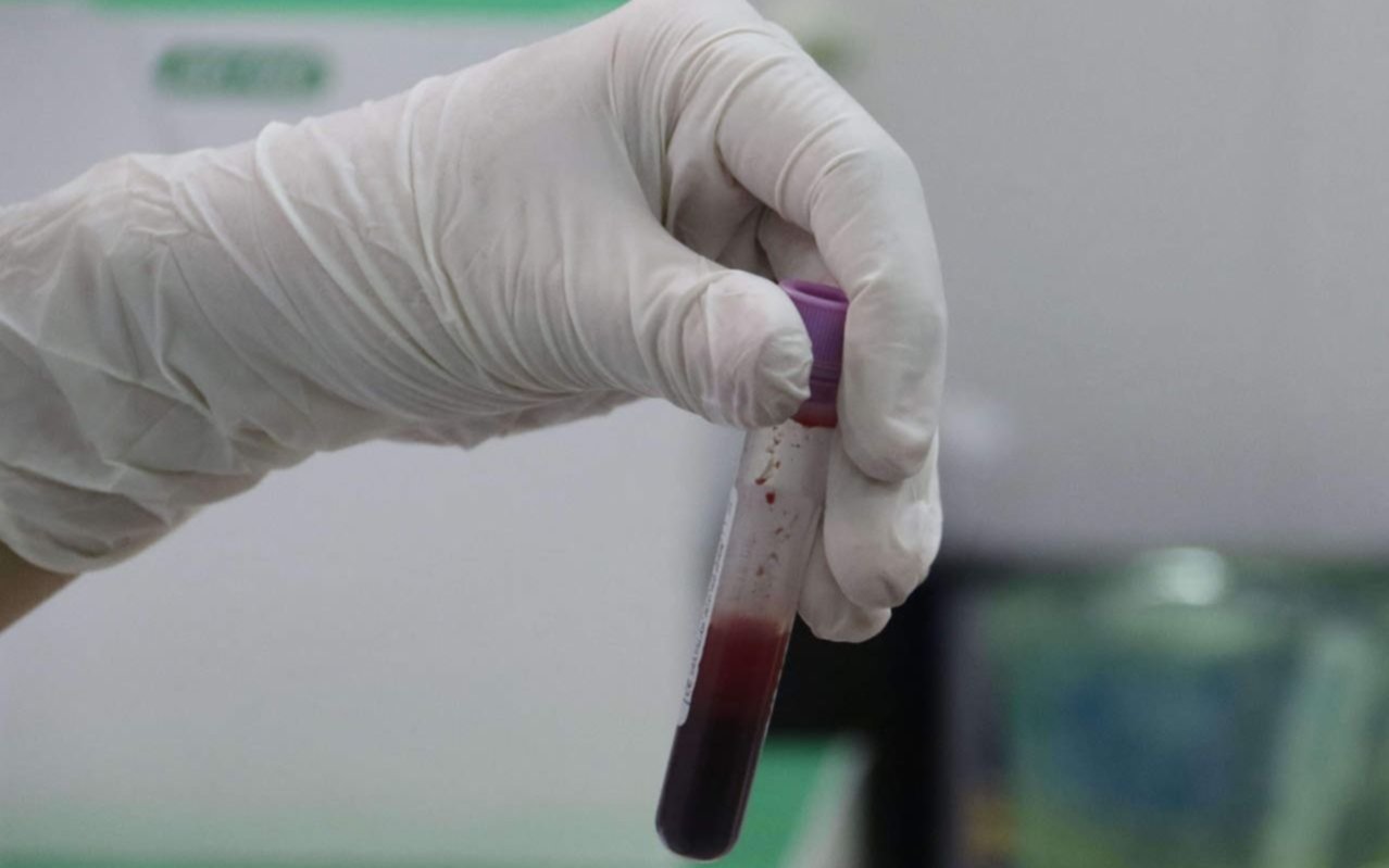 Se desploman las reservas de sangre y hay preocupación