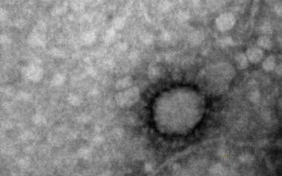 Logran precisar cuánto duran los anticuerpos contra el coronavirus