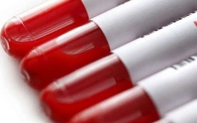 Es importante contar con reservas en los bancos de sangre