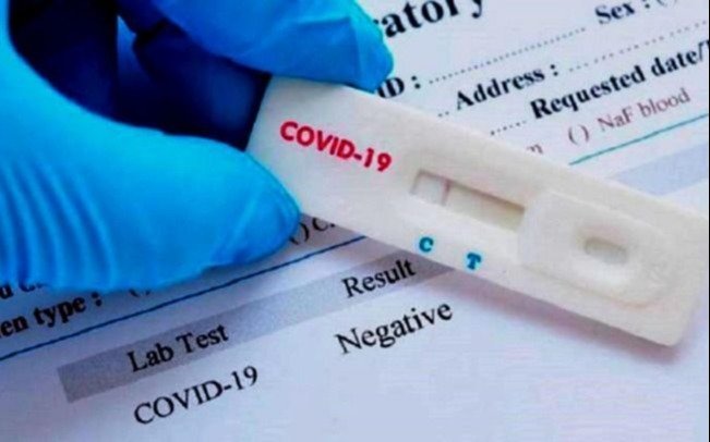 Prohíben la venta en farmacias de tests para detectar el Covid