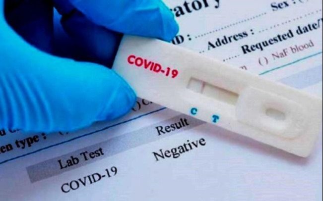 Los testeos masivos son vitales para aislar los casos positivos en el combate al Covid-19