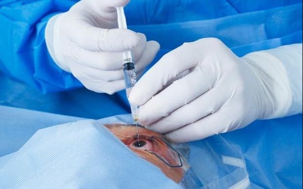 Polémica por cinco córneas donadas que no pudieron llegar
