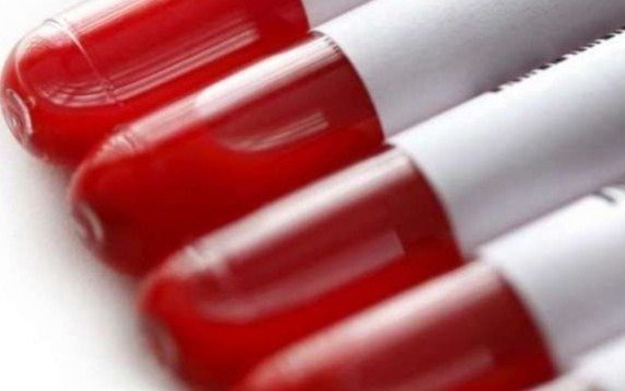 Es imperativo contar con suficientes reservas en los bancos de sangre