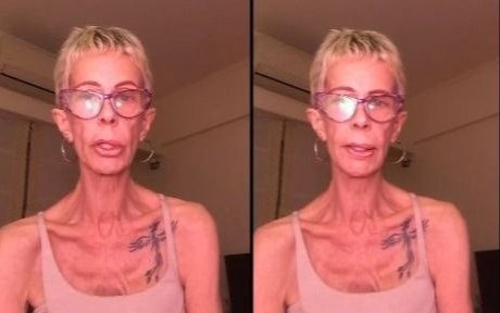 María Valenzuela pesa 35 kilos tras supuesta mala praxis: “No me puedo morir”