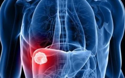 Estudian casos de hepatitis desconocida en menores
