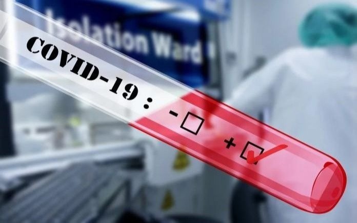 Paciente dio positivo de covid durante 505 días