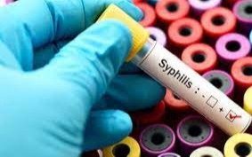 Crece el impacto de la sífilis en la región