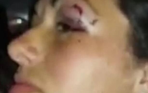 Una mujer denunció una feroz agresión en Berisso