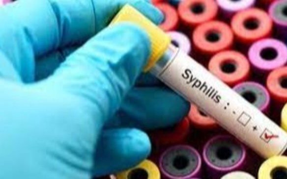 Alertan por la suba de casos de sífilis en el país