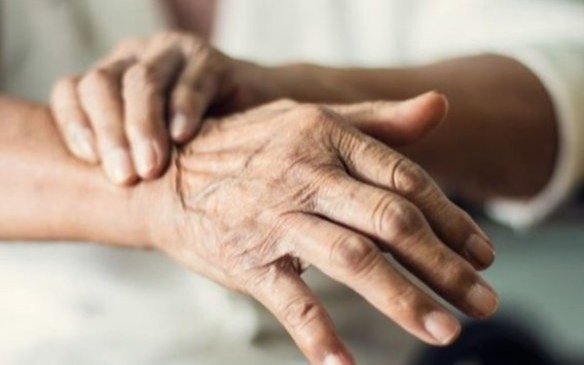 Un hombre con Parkinson avanzado volvió a caminar gracias a un implante