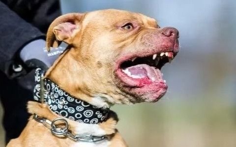 Qué se sabe del ataque de dos Pitbull en La Plata
