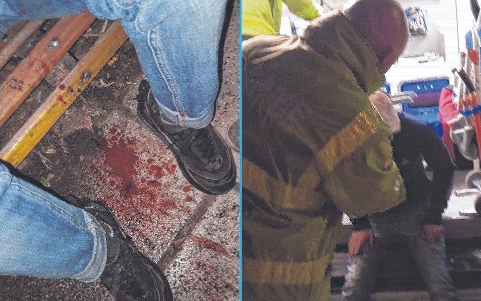 Un joven en grave estado tras sufrir un brutal robo