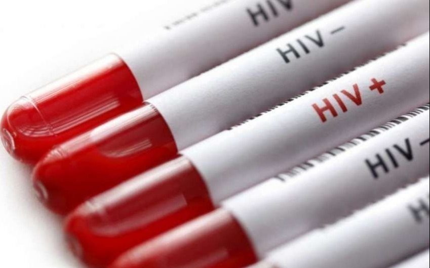 Un nuevo caso de posible curación del VIH