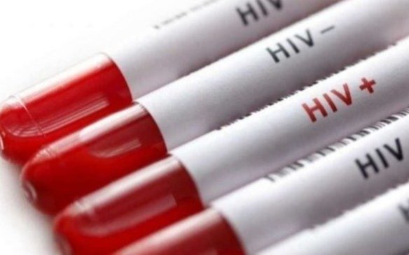 Personas con VIH tendrán cobertura en análisis