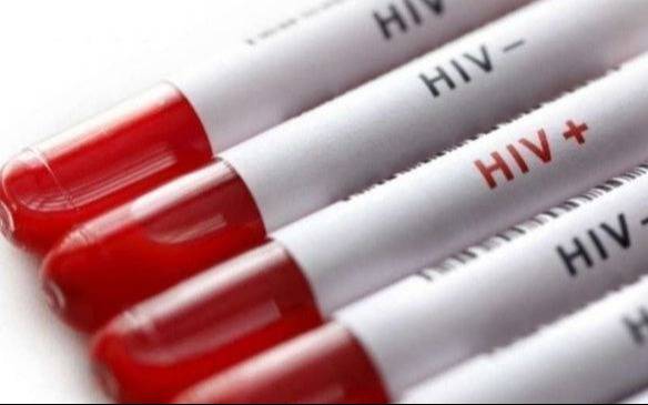 Casi la mitad de las personas con VIH se entera tarde