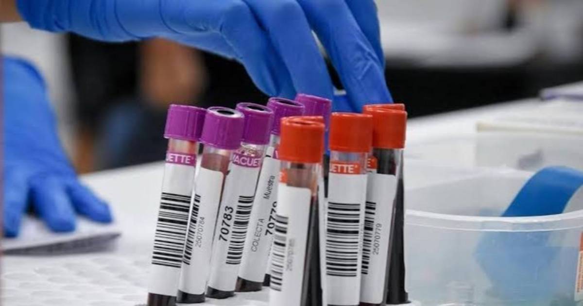 Organizan jornada de donación de sangre en el Rectorado de la UNLP | El Dia