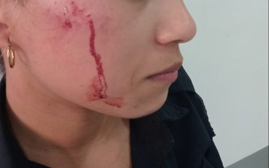 Apedreó a un patrullero, lastimó a una policía y fue preso cuando quiso huir