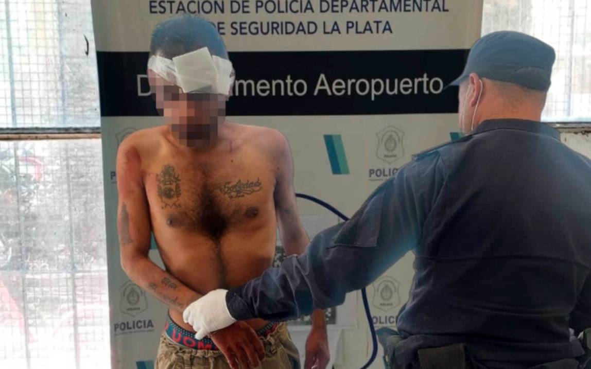 Una mujer agarró a un ladrón y le dejó la cara a la miseria